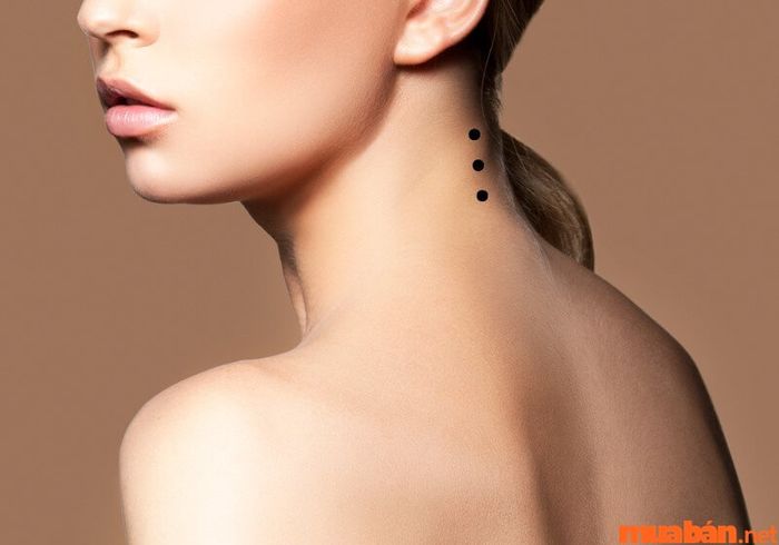 Ba nốt ruồi thẳng hàng sau gáy là hiện tượng hiếm gặp.