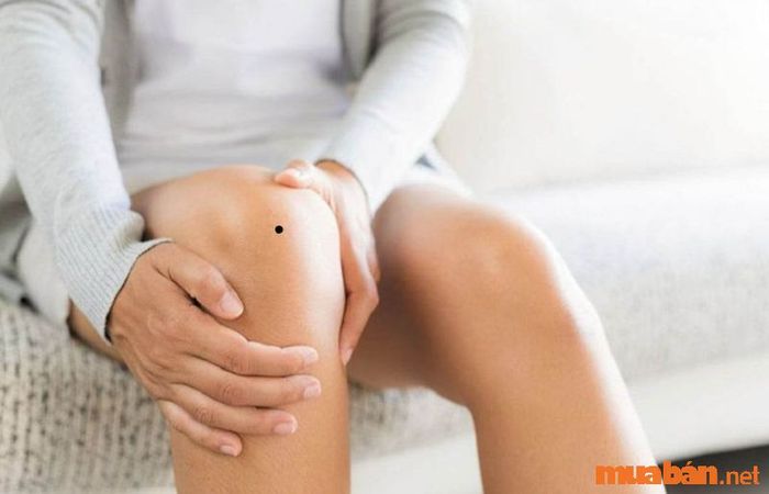 Nốt ruồi ở đầu gối phải của phụ nữ