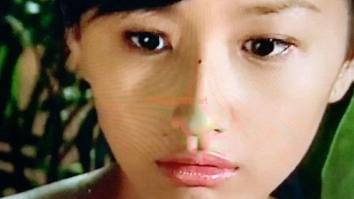 Ý nghĩa của các vị trí nốt ruồi