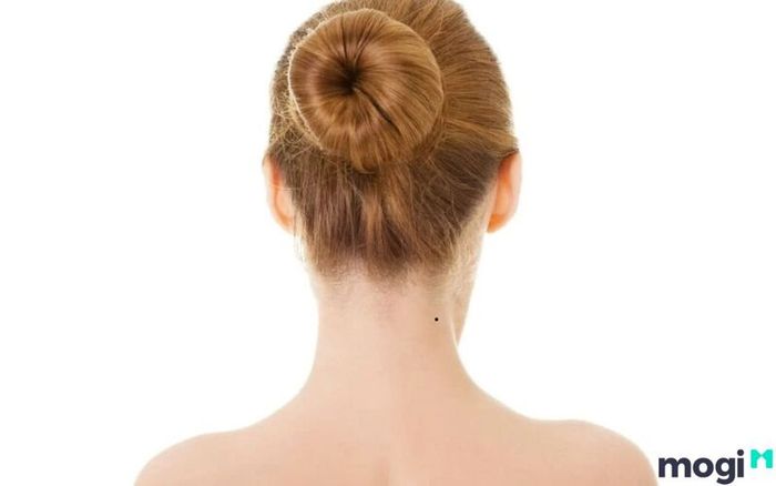 Nốt ruồi sau gáy có ý nghĩa như thế nào?