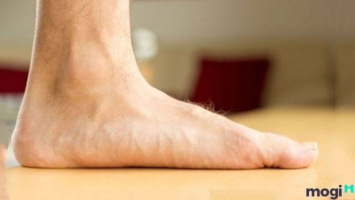 Tướng bàn chân sướng với lông ngón chân dày và rậm phản ánh cuộc sống sung túc, may mắn và sự nghiệp thăng tiến.