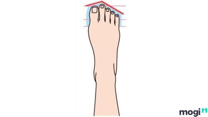 Tướng bàn chân với ngón thứ 2 dài nhất