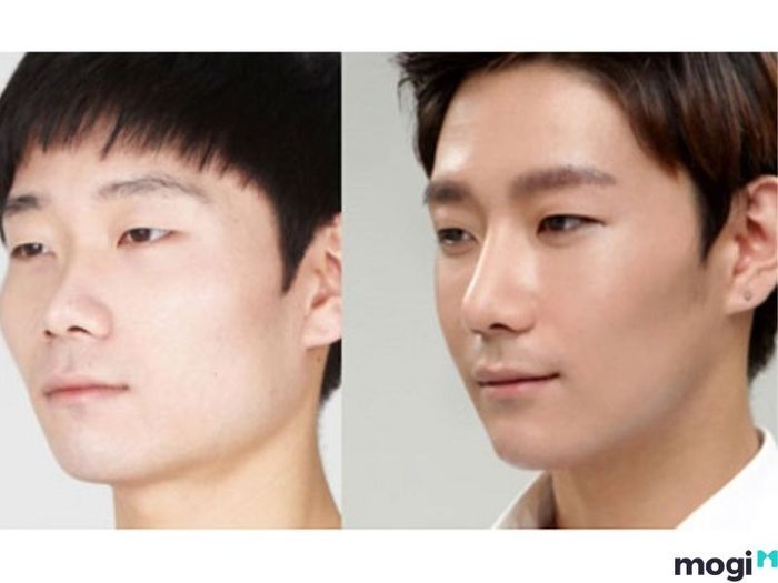 Đàn ông gò má cao có thể cải thiện bằng cách massage mặt