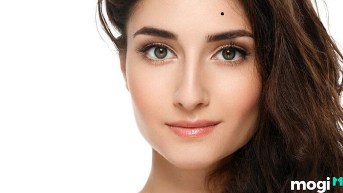 nốt ruồi ở trán