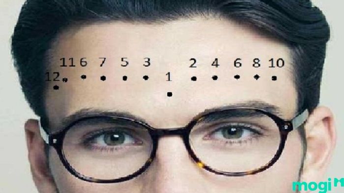 nốt ruồi trên trán