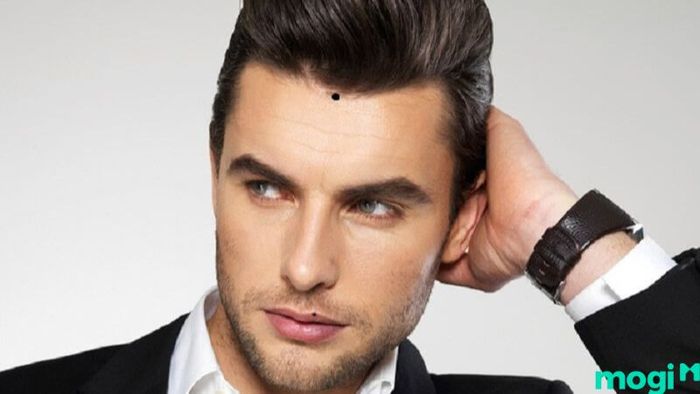 nốt ruồi trên trán