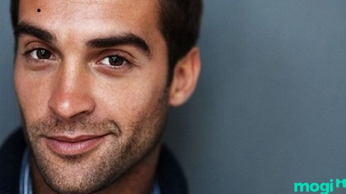 nốt ruồi trên trán