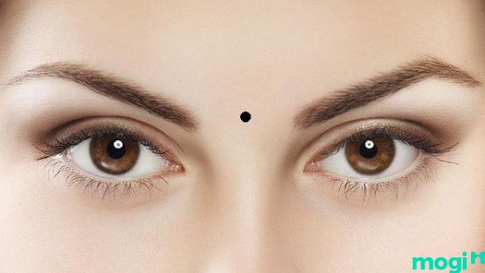 nốt ruồi ở trán