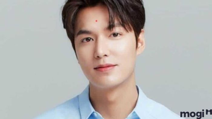 nốt ruồi ở trán