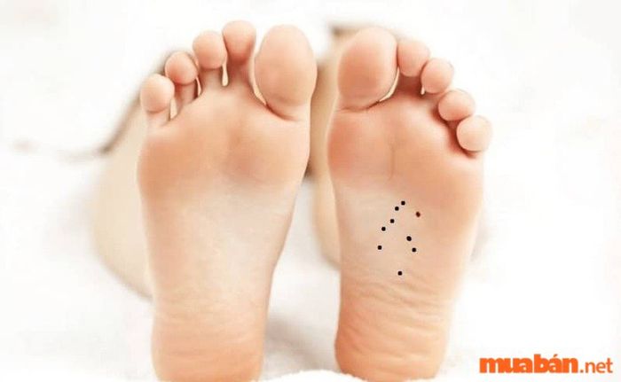 Nốt ruồi bàn chân