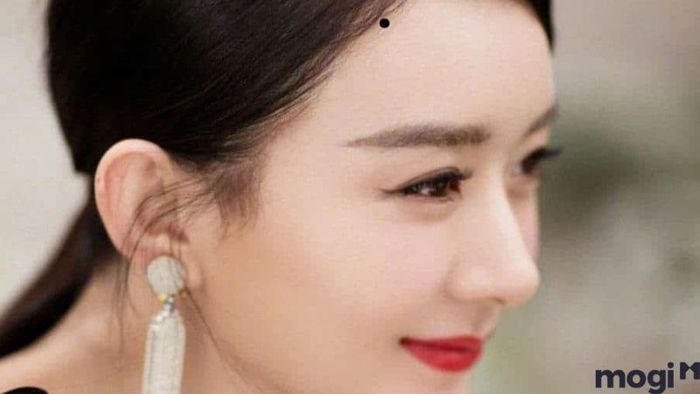 nốt ruồi ở trán