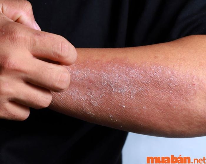 Ngành da liễu bao gồm những kiến thức và kỹ năng nào?