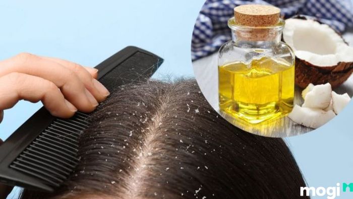 Chăm sóc tóc với dầu dừa