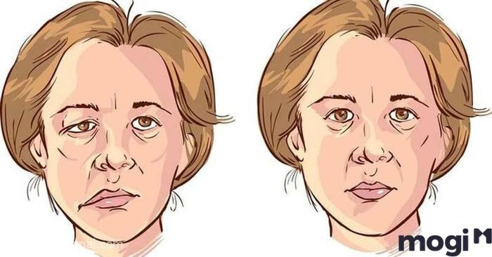 Nhân tướng học khuôn mặt lệch