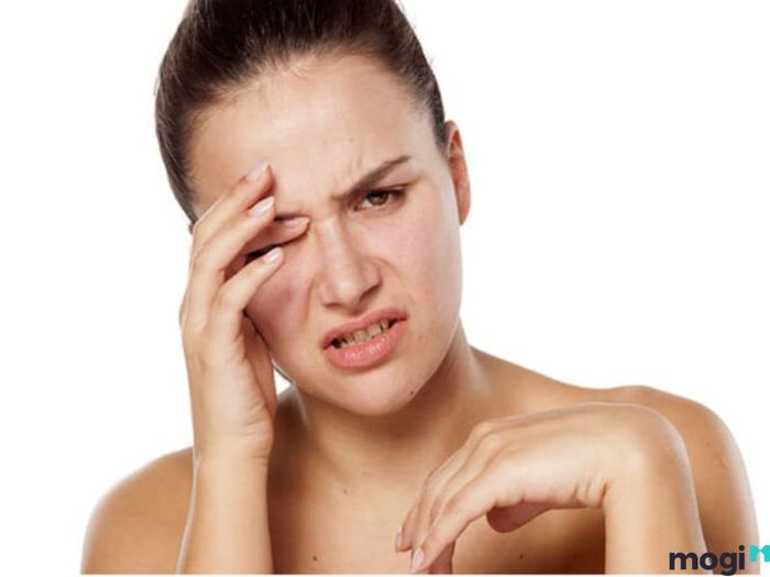 Giải Thích Hiện Tượng Giật Lông Mày Trái Theo Khoa Học