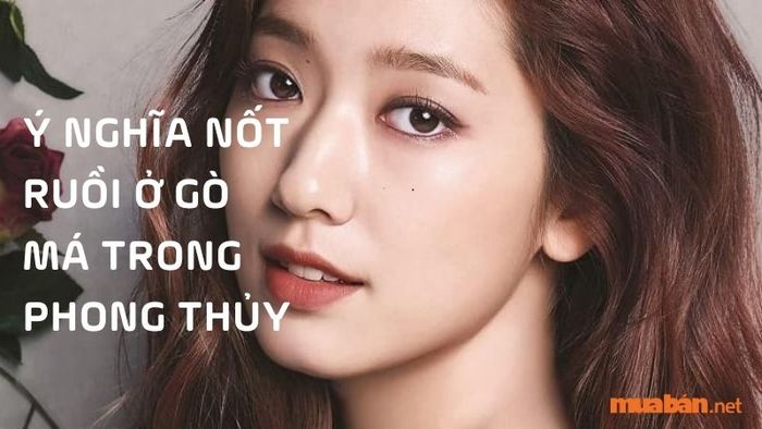 Nốt Ruồi Ở Gò Má