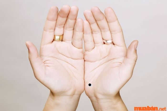 Nốt ruồi tại gò Thái Âm