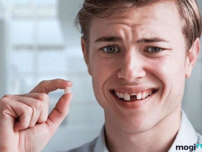 Giấc Mơ Rụng Răng Do Căng Thẳng: Ý Nghĩa Là Gì?