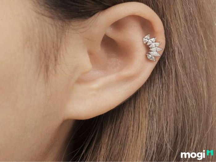 Lông trắng mọc trên mặt