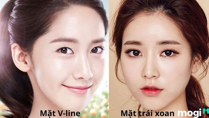 So sánh giữa mặt trái xoan và mặt V-line