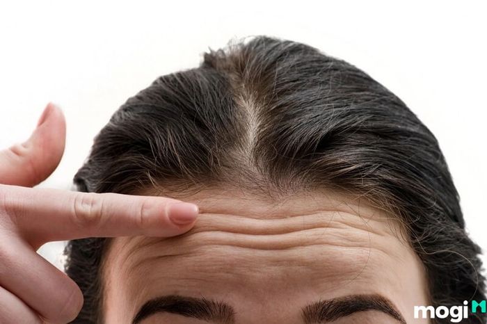 Trán quá thấp có thể là biểu hiện của sự kém thông minh.