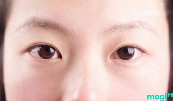 Mắt 1 mí là gì - Giải thích về tướng mắt đặc biệt này