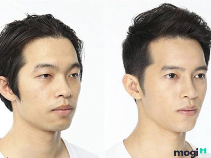 Ảnh hưởng của cằm lẹm đến công danh, sự nghiệp của nam giới