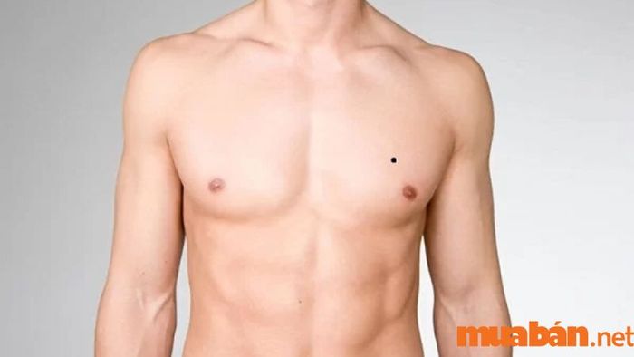 Nốt ruồi ở ngực gần nách