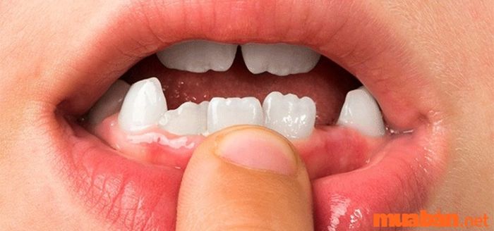 Nhân tướng học cho rằng phụ nữ có hàm răng thưa, không đều là dấu hiệu của người không có phẩm chất tốt, thiếu sự ổn định.