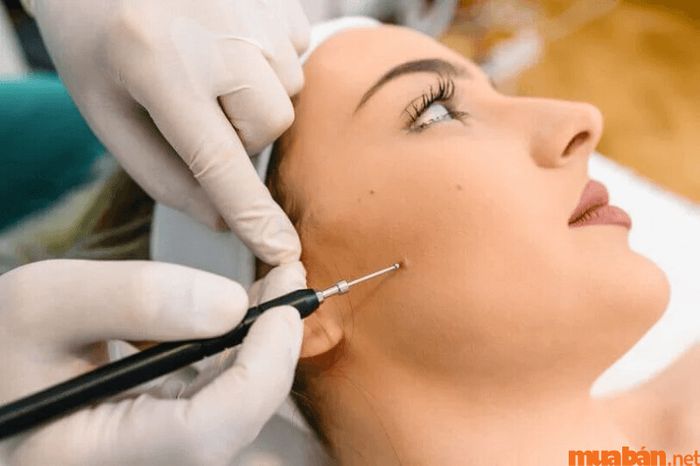 7 vị trí nốt ruồi giàu sang phú quý