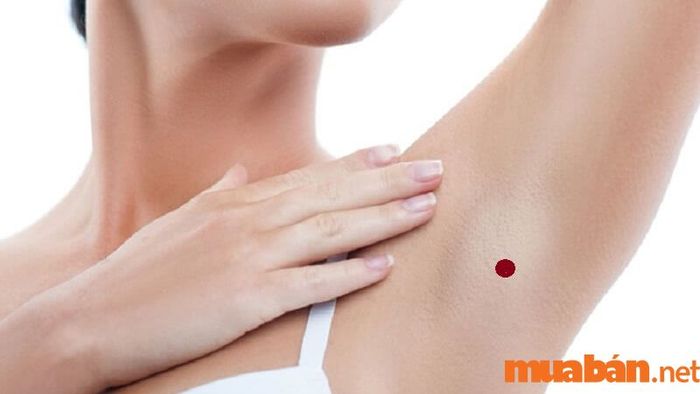 Nốt ruồi son ở nách