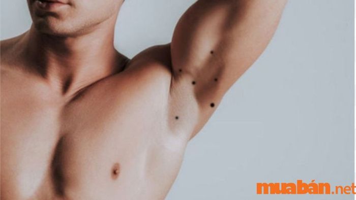 Nốt ruồi ở nách là điềm tốt hay xấu, có nên loại bỏ không?