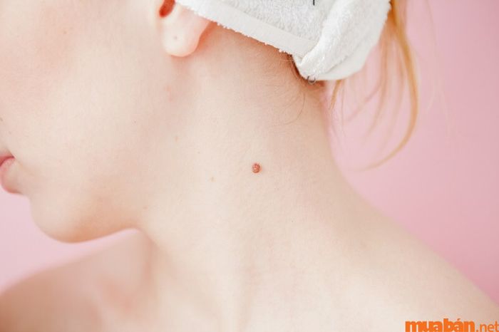 7 vị trí nốt ruồi mang lại sự giàu có và phú quý