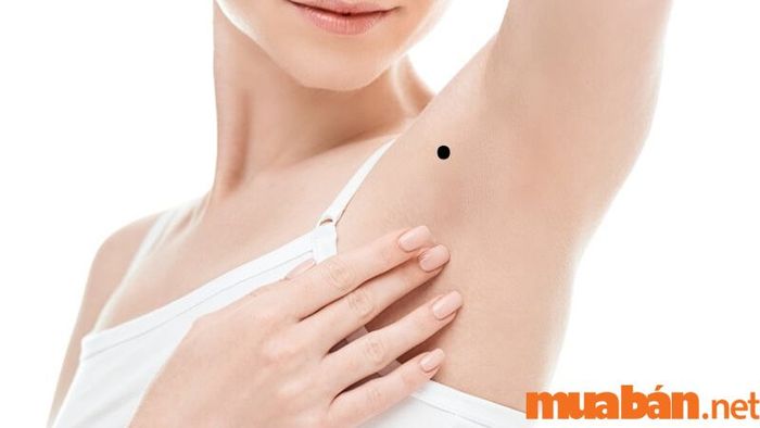Nốt ruồi gần nách ở vùng vai