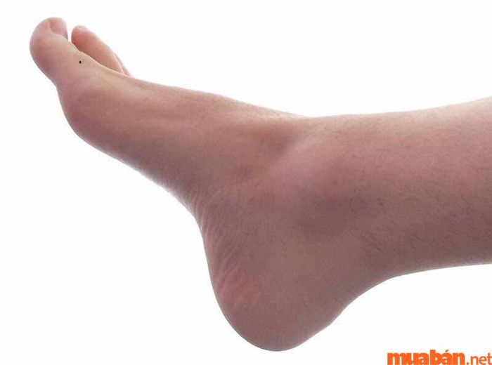 nốt ruồi ở ngón chân cái