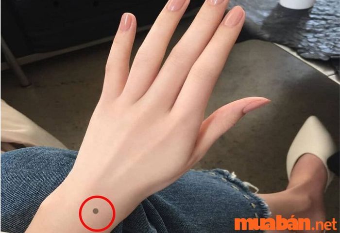 nốt ruồi trên mu bàn tay