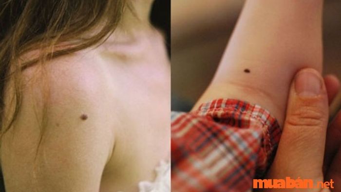 Ý nghĩa của nốt ruồi vượng phu