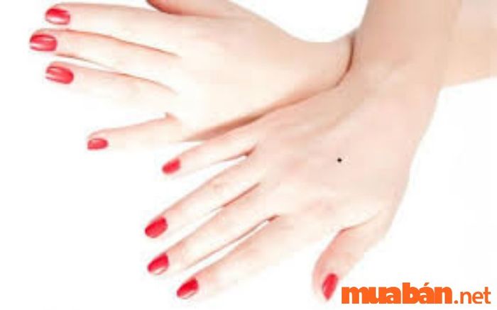nốt ruồi trên mu bàn tay