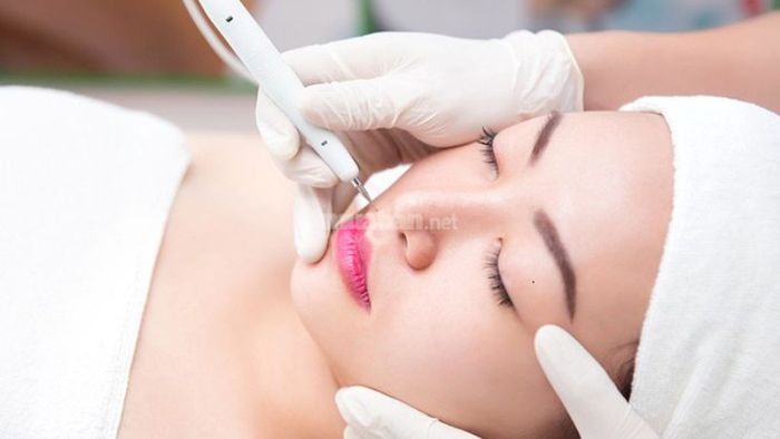 Có Nên Xóa 3 Nốt Ruồi Thẳng Hàng?