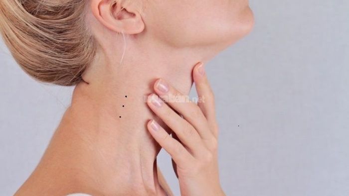 Nốt Ruồi Trên Cổ