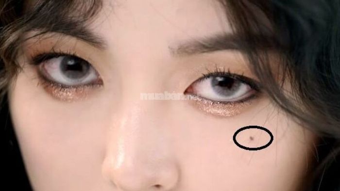 Nốt ruồi lệ là gì? Ý nghĩa của nó tại các vị trí cụ thể trên cơ thể ra sao?