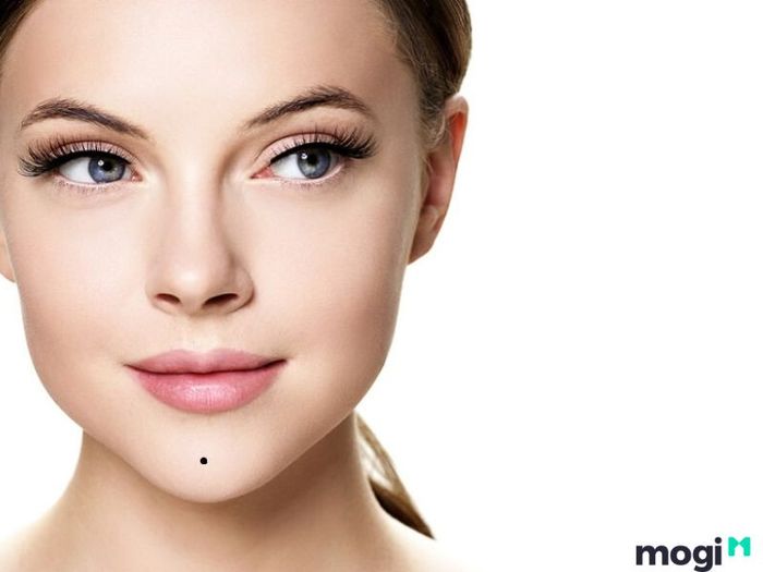 nốt ruồi dưới cằm