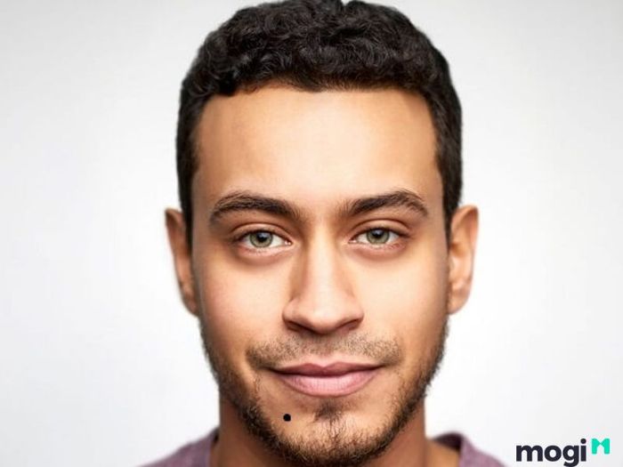 nốt ruồi dưới cằm trái ở nam giới