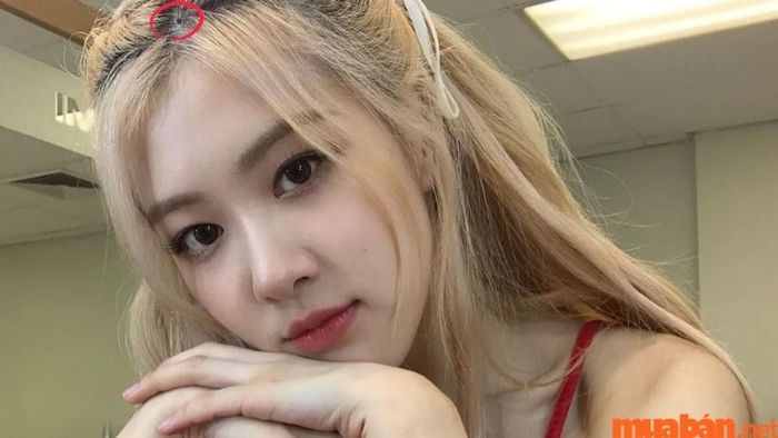 Nốt ruồi trên đỉnh đầu của nữ giới