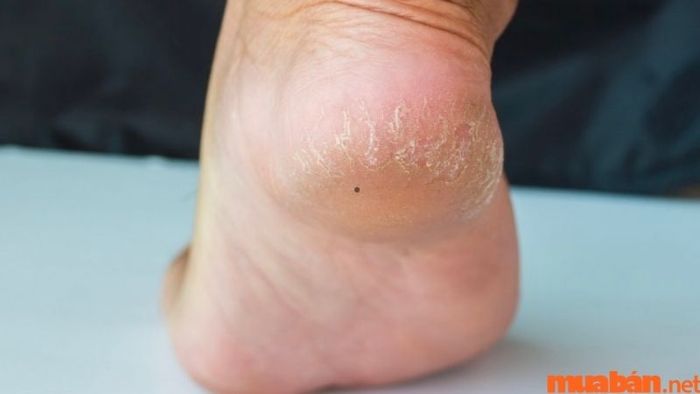 Họ thường là những người đàn ông đào hoa, thu hút sự quan tâm của nhiều người xung quanh.