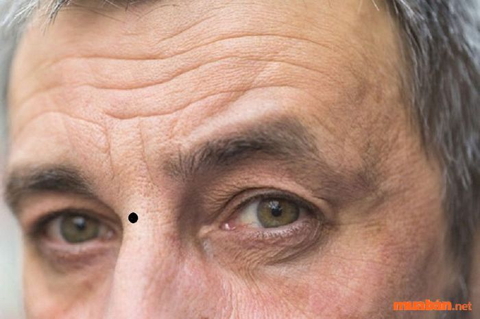 Nốt ruồi trên sơn căn báo hiệu một tương lai không mấy thuận lợi