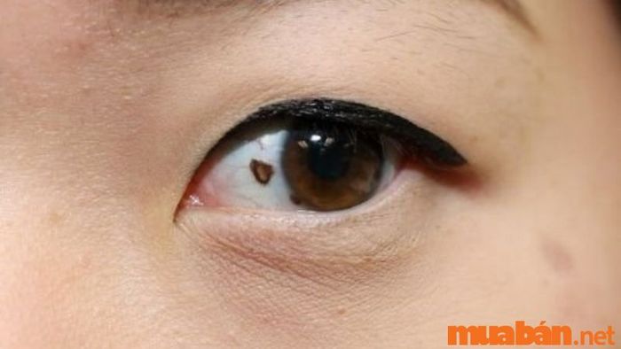 Nốt ruồi trong mắt trái ở nữ giới có ý nghĩa gì?