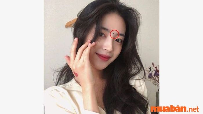 Những nốt ruồi mang lại vận may