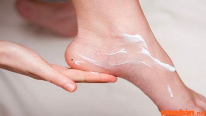 nốt ruồi ở mép gót chân