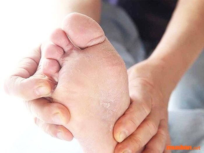 Lòng bàn chân khô cứng là biểu hiện của một cuộc đời đầy gian nan và thử thách, với nhiều thất bại trước khi gặt hái được thành công